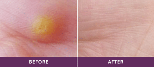 Before-and-after-3