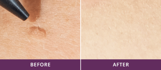 before-and-after-2