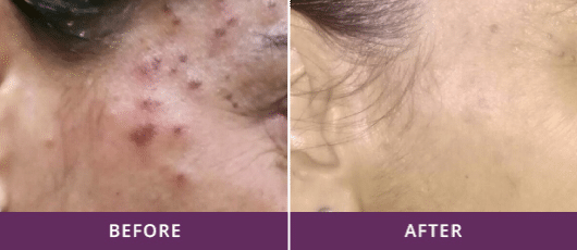 before-and-after-4-1