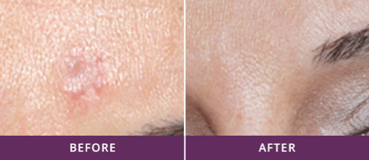 before-and-after_1